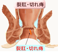 ����E�؂ꎤ