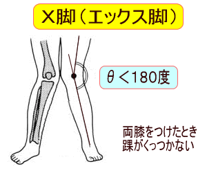 �w�r